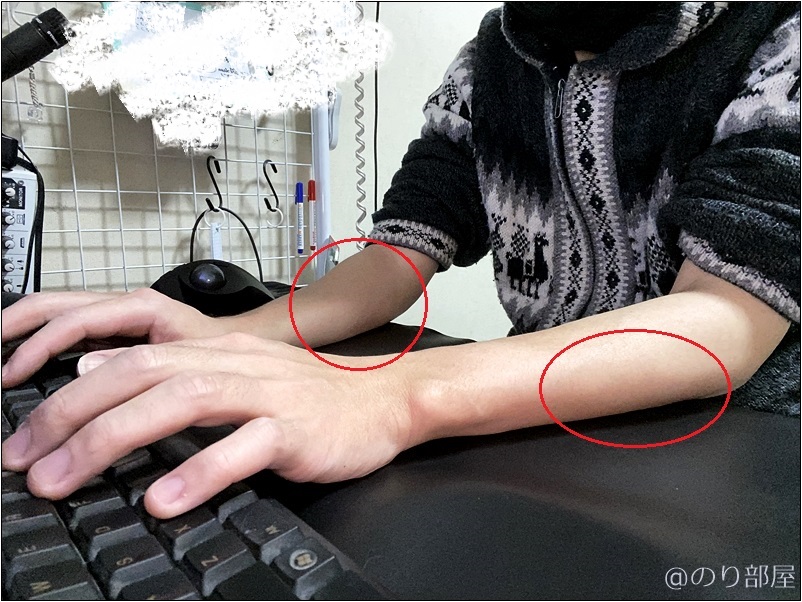 PCのキーボードを使用して痛める腕･肘の部分【痛み緩和】PCの腕･手首の痛みにオススメアイテム! キーボードで前腕のスレ･痛みを減らせるリストレスト･パームレストの使い方【パソコンのクッション】